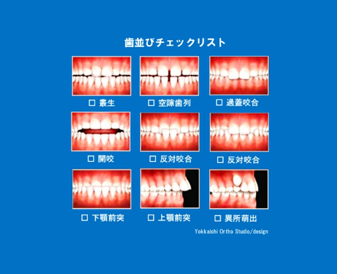 歯並びセルフチェック - 三重県四日市のよっかいち矯正歯科医院 